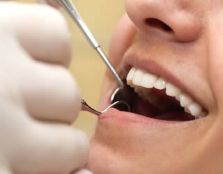 Dry Socket Following Tooth Extraction